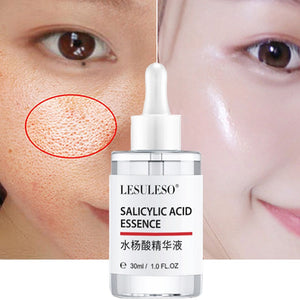 Hyaluronic Acid Pore Shrink Face Serum