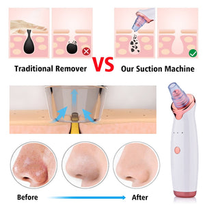 Electric Facial Blackhead Remover