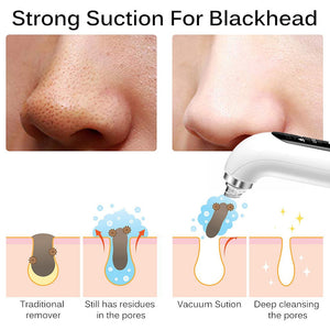 Blackhead Remover Pore Vacuum Face Cleaner