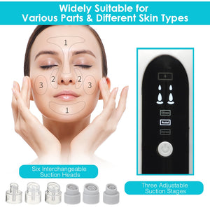 Blackhead Remover Pore Vacuum Face Cleaner